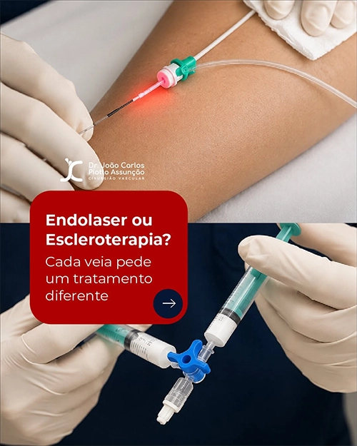 Post do Instagram