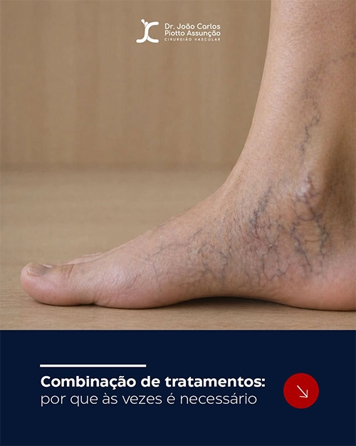 Post do Instagram